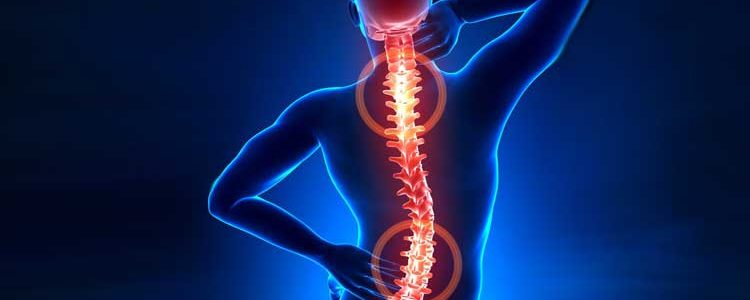 Pilates auxilia no tratamento da hérnia de disco